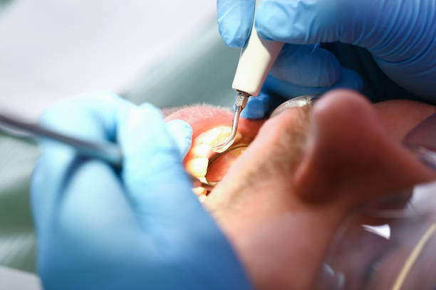 Best Emergency Dental Care for Broken or Chipped Teeth in Luck, WI