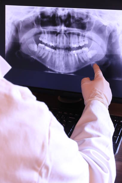 Best Emergency Dental Care for Broken or Chipped Teeth in Luck, WI